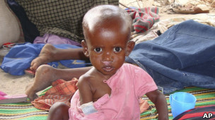 Menina desnutrida somali em um edifício em ruínas, em foto de 9 de julho de 2011, antes de se juntar à sua família, em um campo de refugiados em Mogadishu, na Somália (AP)