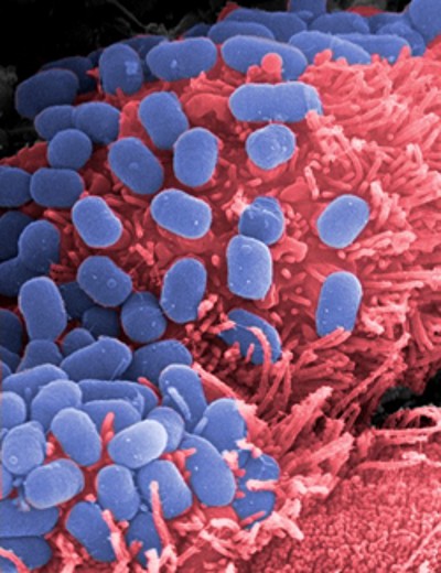 As bactérias E. coli são usadas e manipuladas na forma intensiva e extensiva pela indústria, o que está a favorecer a criação de novas estirpes continuamente.